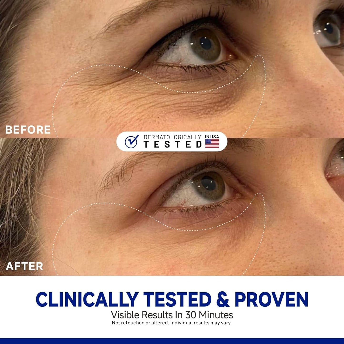 Peptide Jojoba Under Eye Patches 60 Pcs