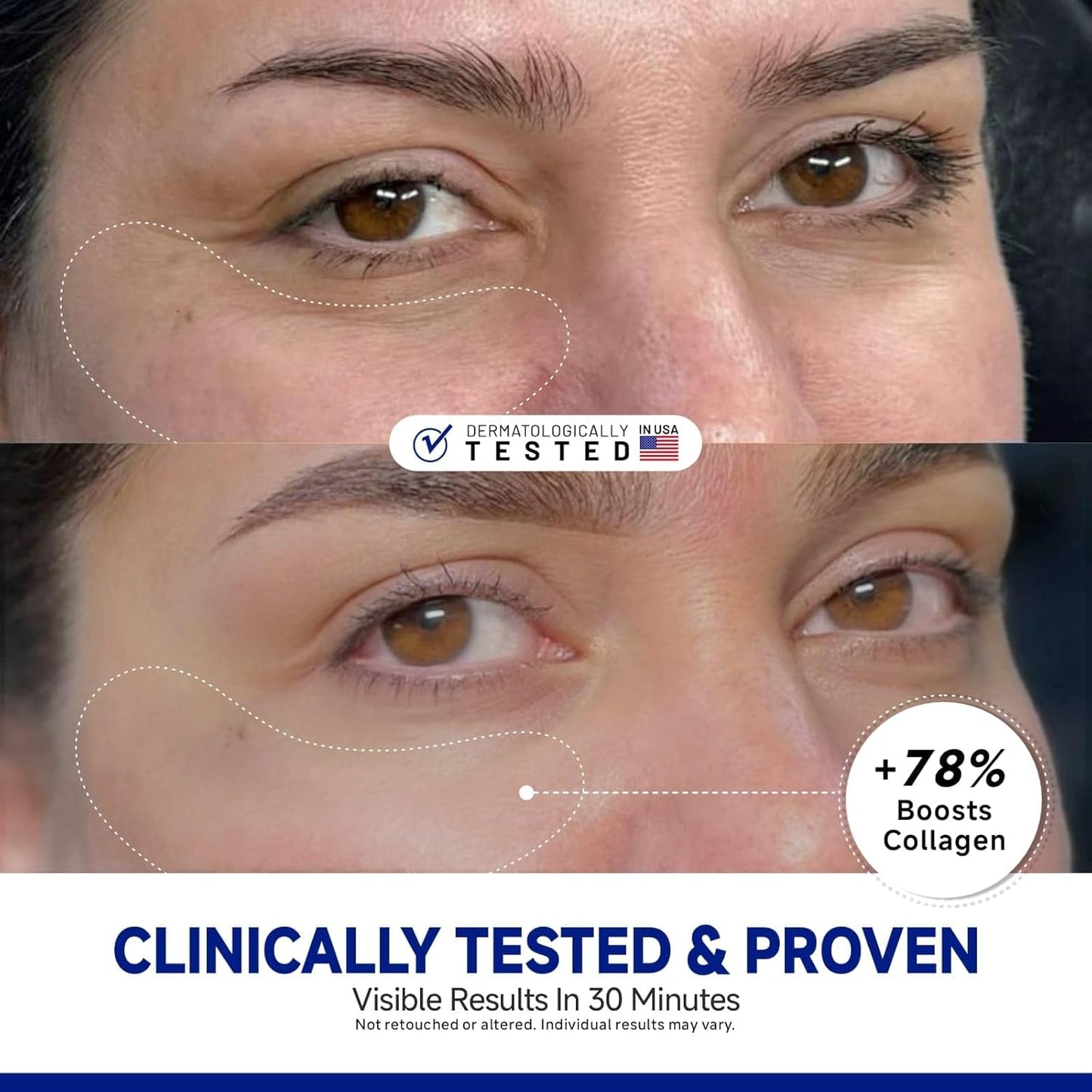 Peptide Under Eye Patches  for Bags Treatment  Wrinkles 24 Pairs